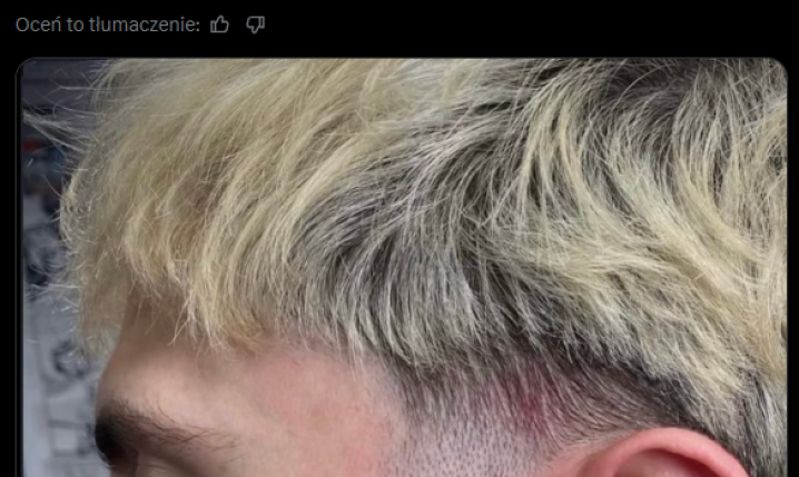 Alejandro Garnacho ma NOWY TATUAŻ NA TWARZY!